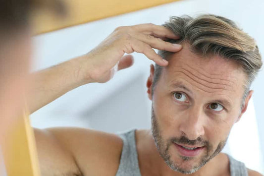Man met inhammen en een terugwijkende haarlijn