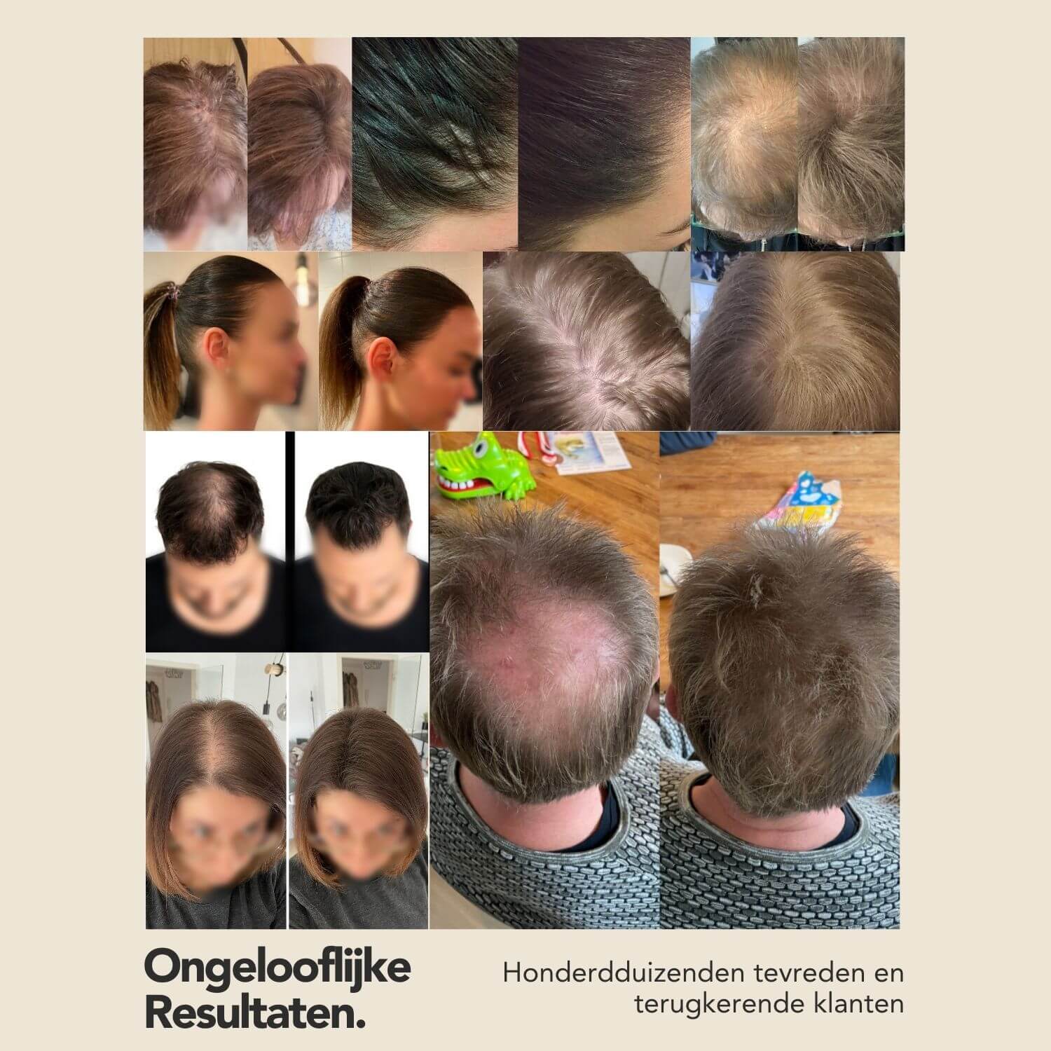 IMPERIO Haarvezels · Alopecia · Haaruitval Vrouwen · Kaalheid Mannen · Middenscheiding · Toppik · Kale plekken