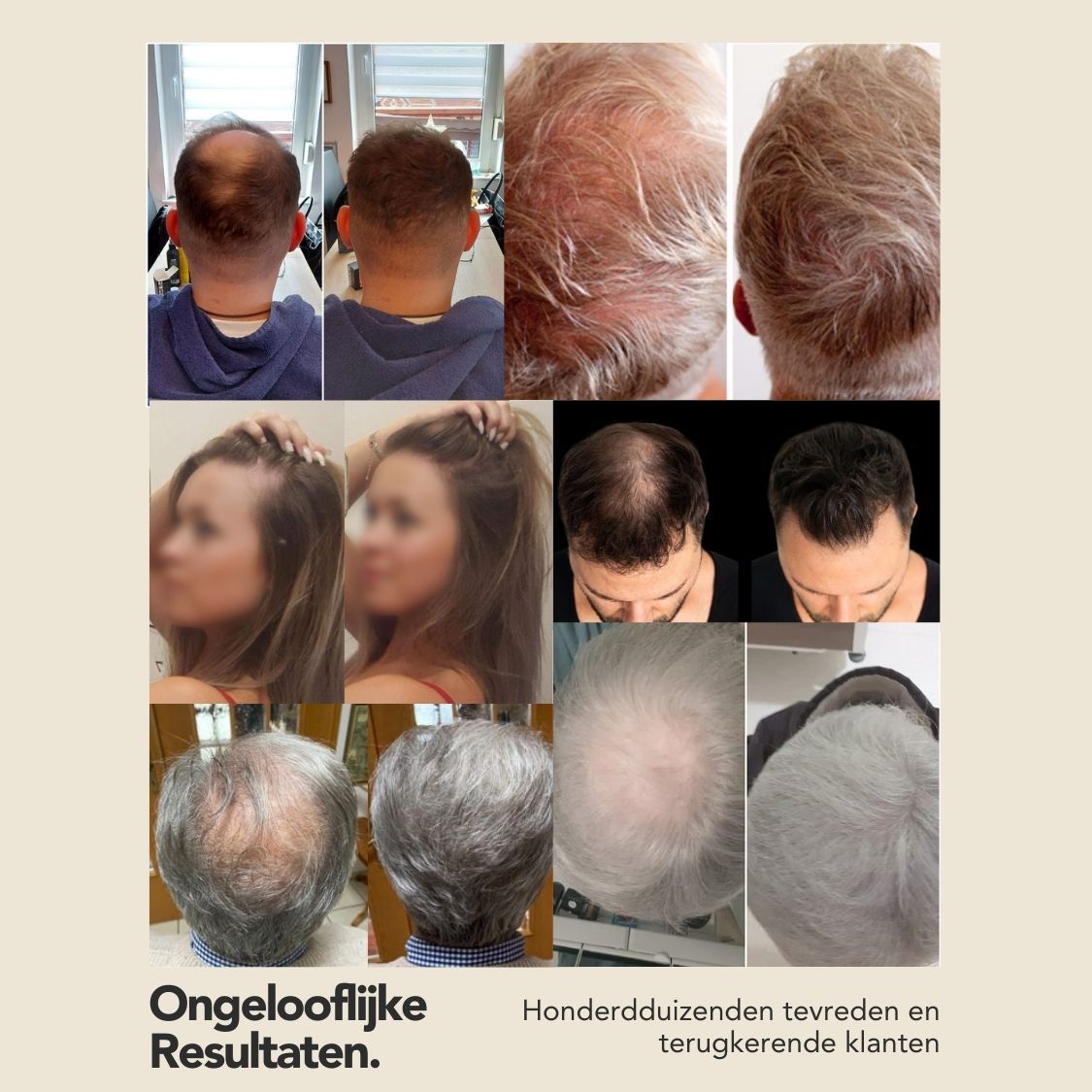 IMPERIO Haarvezels · Alopecia · Haaruitval Vrouwen · Kaalheid Mannen · Middenscheiding · Toppik · Kale plekken